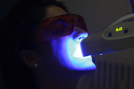 sbiancamento denti empoli